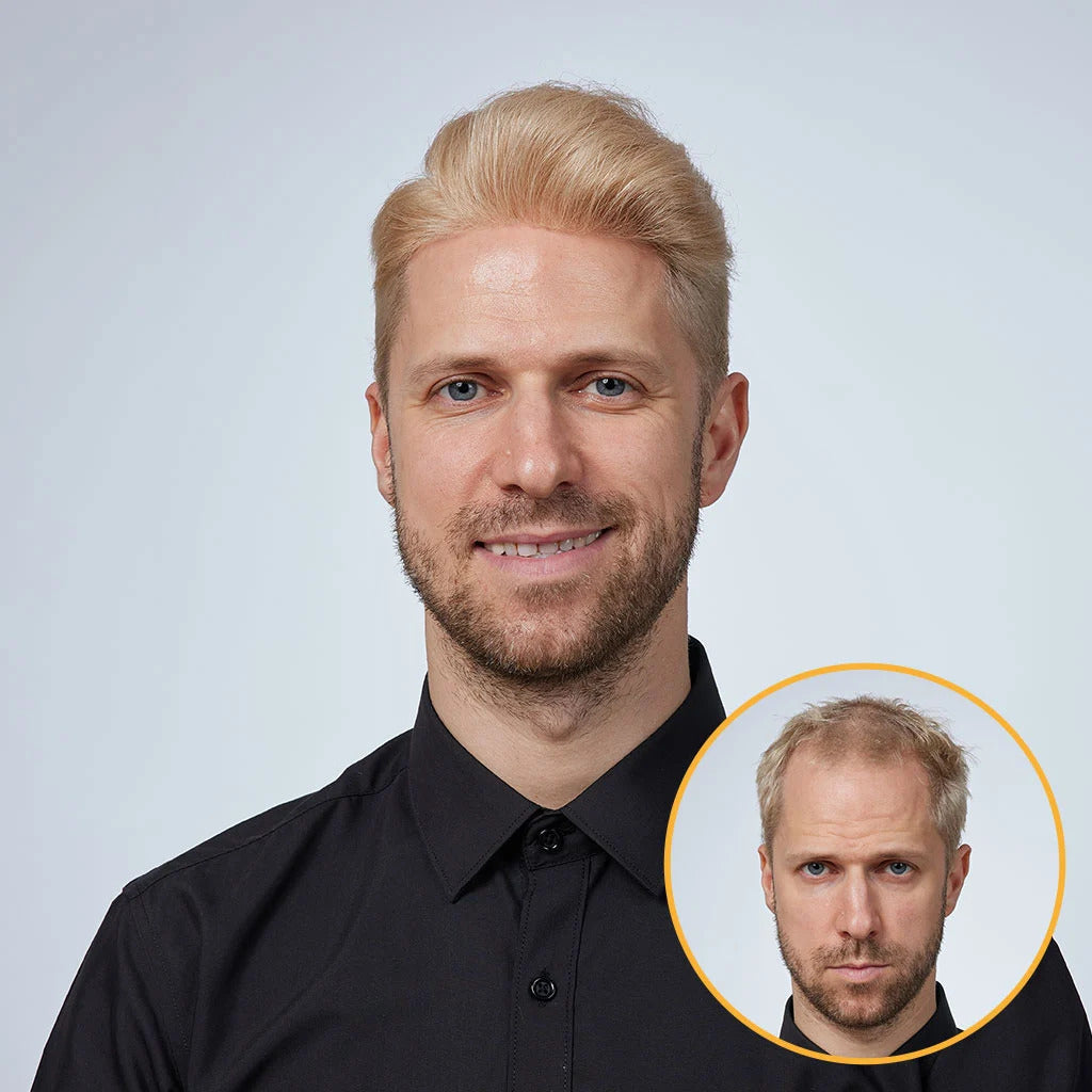 HS1: Transparent Hair System (Poly Skin)