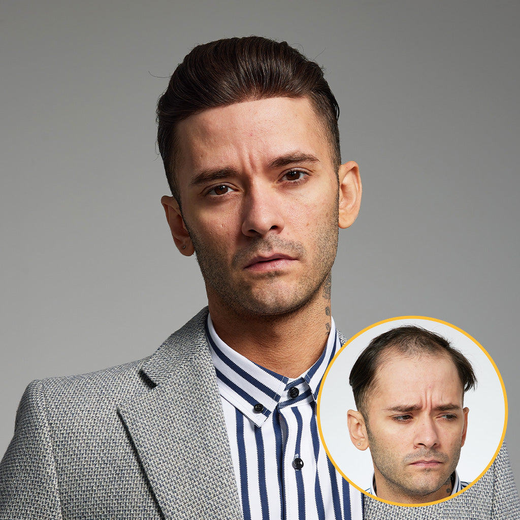 HS1VMN: 0.06mm Hair System, 130% Density (Thin Skin)