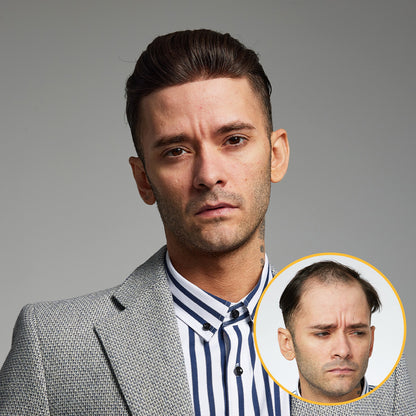 HS1VMN: 0.06mm Hair System, 130% Density (Thin Skin)
